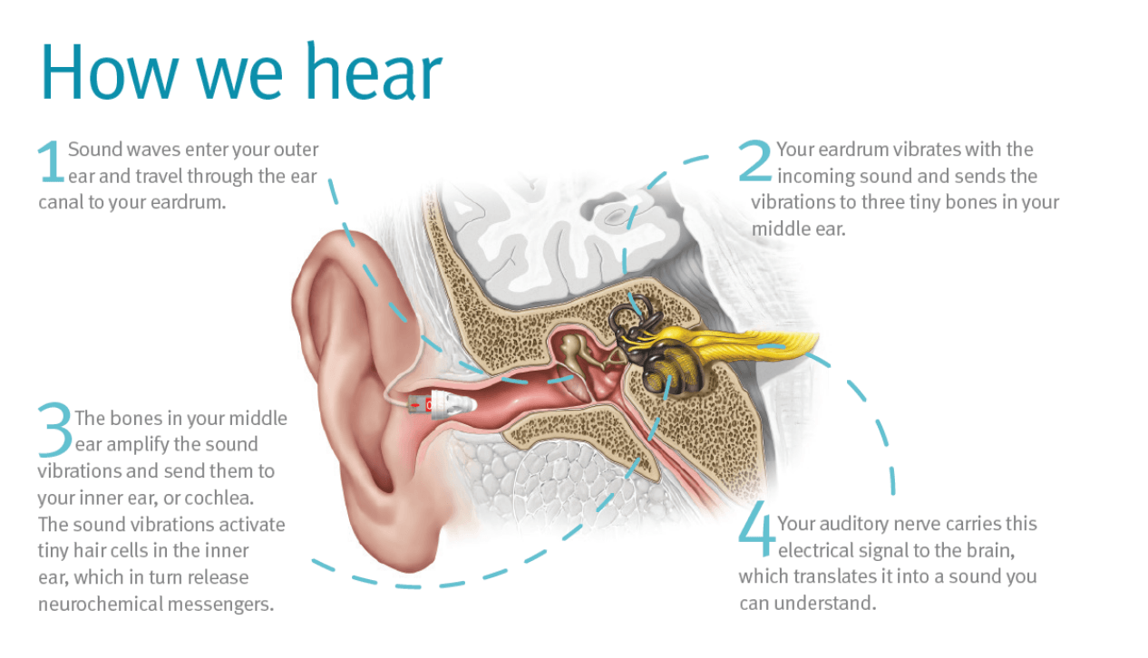 Which Condition Would Cause Conductive Hearing Loss In A Patient Quizlet