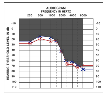 audiogram frequency